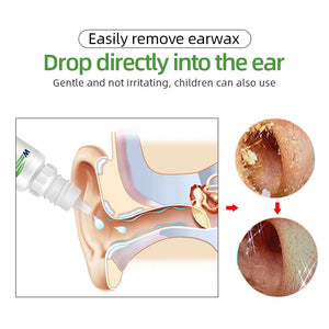 10ml Ear Drops Sodium Bicarbonate Earwax Cleaner Liquid Acute and Chronic Otitis Ear Tinnitus/Deafness Sore Health Caring