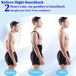 Corrector De Postura De Espalda Adjustable Back Support Belt Spinal Support Fixed Belt Reshaping Body Posture Correction Belt