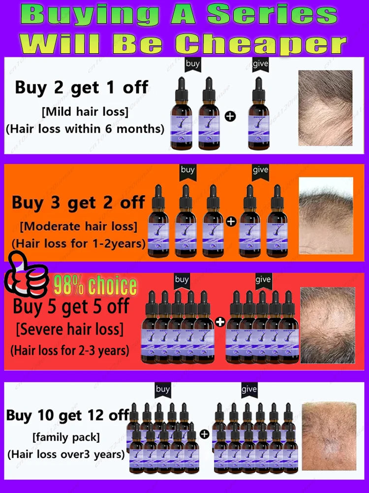 Fast Hair Growth Essence Effective Anti Hair Loss Serum Baldness Repair Hereditary Postpartum Seborrheic Hair Loss   Care